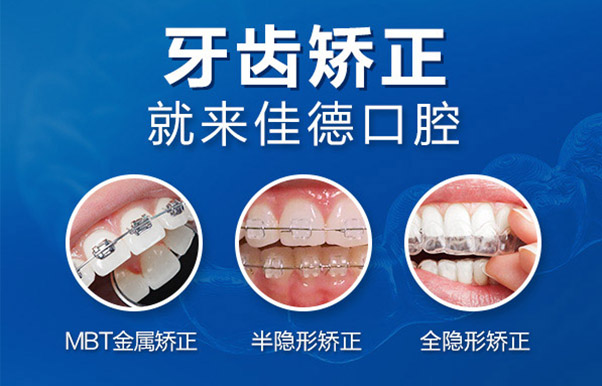 肥西成年人牙齿稀疏能矫正吗？