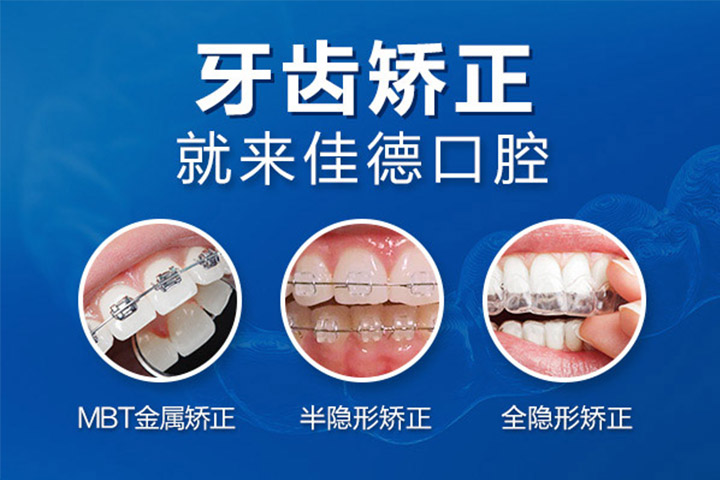 肥西佳德众兴口腔牙齿矫正方法有哪些？