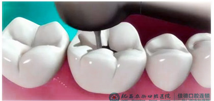 肥西较好的牙科医院是哪家？