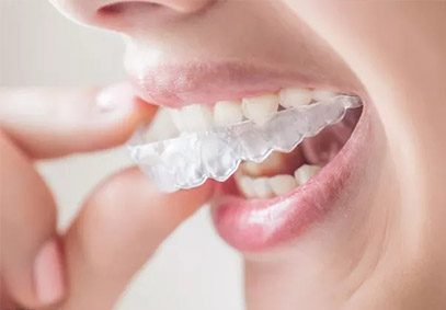 牙齿稀疏在肥西做矫正要花多少钱？