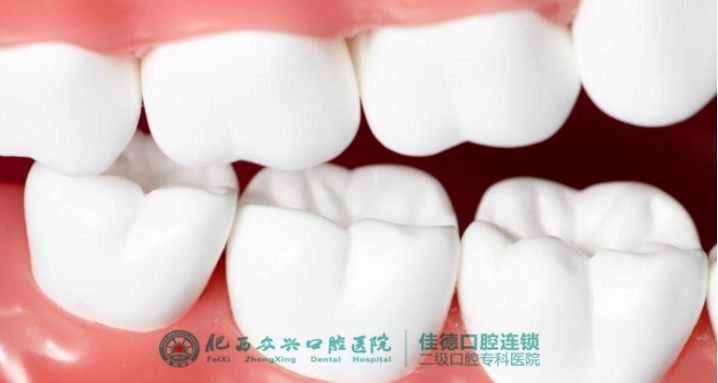 肥西牙齿烟渍牙怎么美白？