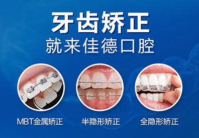 肥西牙科医生介绍牙齿不齐的种类？