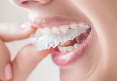 肥西牙齿矫正要多少钱？