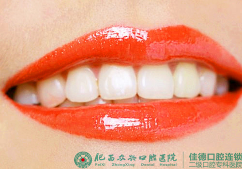 四环素沉着牙可以通过洗牙美白吗？