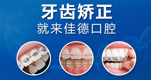 肥西牙齿拥挤矫正多少钱？