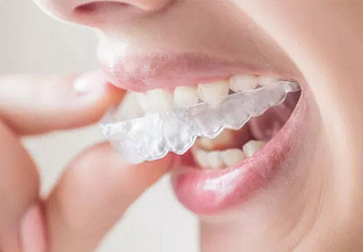 如何选择牙齿矫正方法？