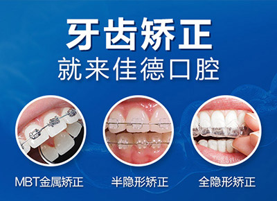 牙齿稀疏可以在肥西哪家做矫正？