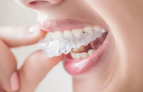肥西成人可以矫正牙齿吗