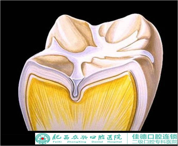 六龄齿窝沟封闭多少钱