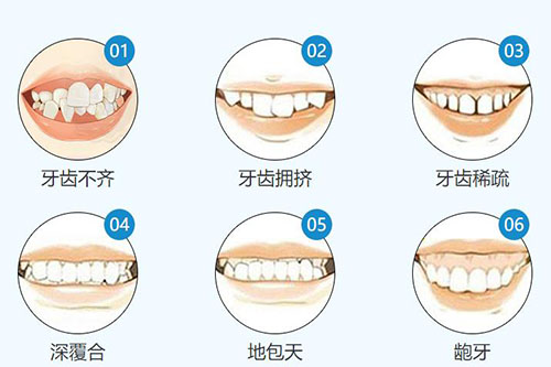 牙齿畸形