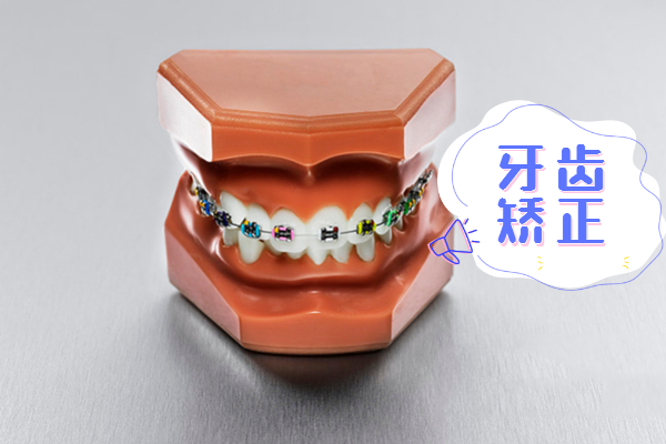 牙齿矫正