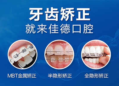 肥西牙齿错位怎么矫正？