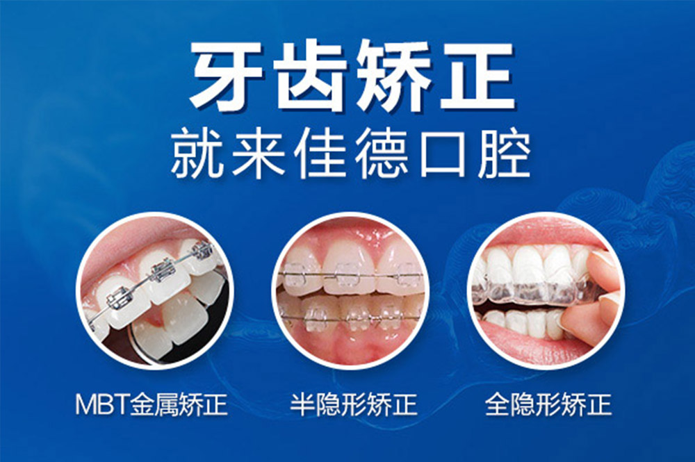 肥西拔牙一般多少钱？