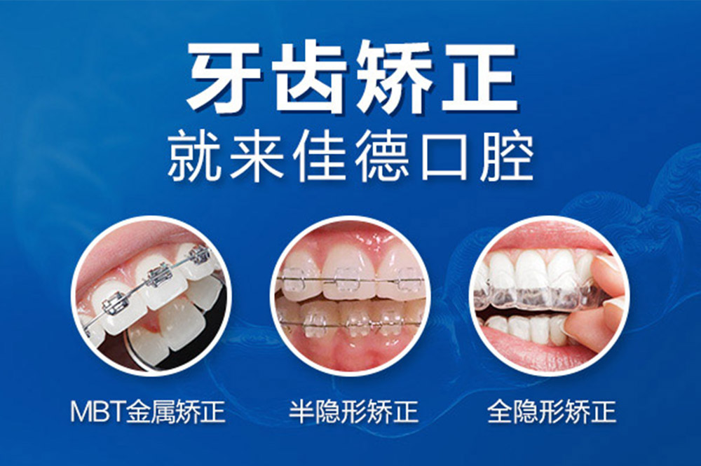 肥西牙齿错位矫正费用？