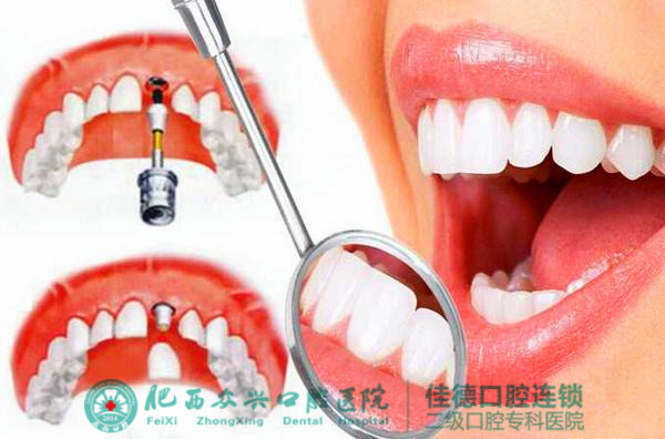 牙齿掉了一颗牙怎么办？