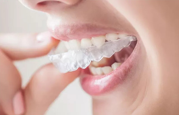 肥西佳德众兴口腔做牙齿矫正好不好？