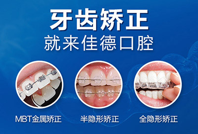 虎牙矫正可以去肥西哪里？