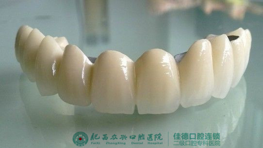 如何让烤瓷牙使用更久？