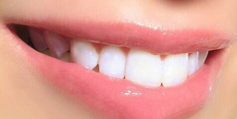 肥西洗牙多少钱一次？
