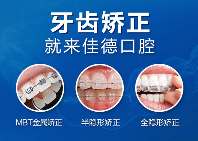 肥西门牙有缝难看怎么办？