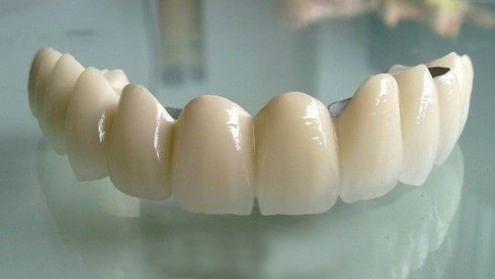 肥西镶烤瓷牙容易掉吗？