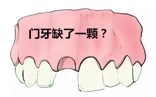 门牙掉了怎么修复比较好？