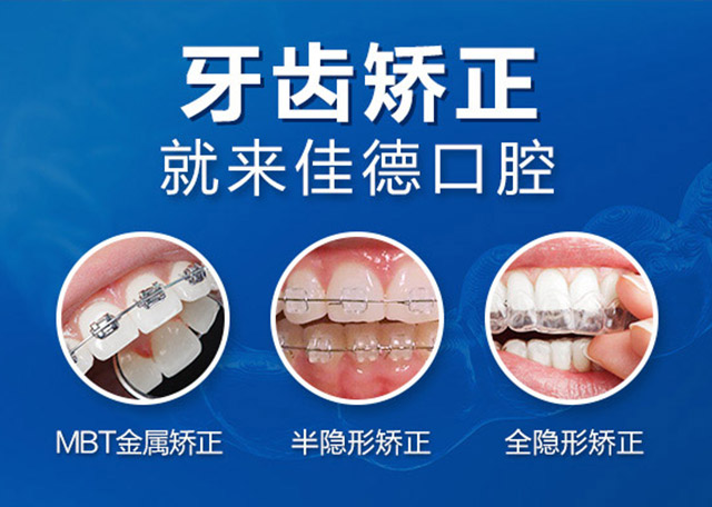 肥西哪家医院牙齿矫正好？