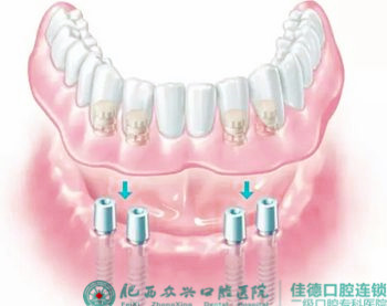 种个牙齿肥西哪家牙科医院好？