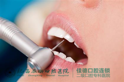 肥西洗一次牙价格多少？