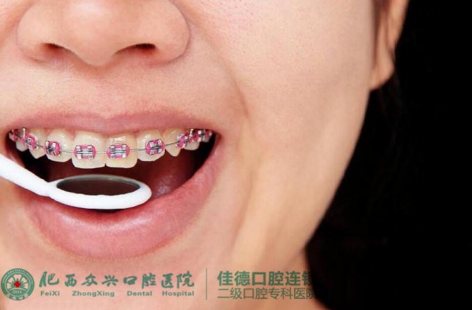 肥西牙齿矫正多少钱？