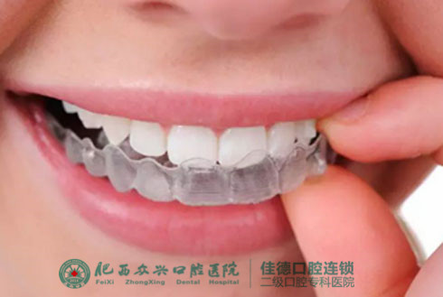 肥西牙齿矫正费用多少？