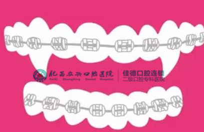 肥西儿童牙齿矫正费用多少？