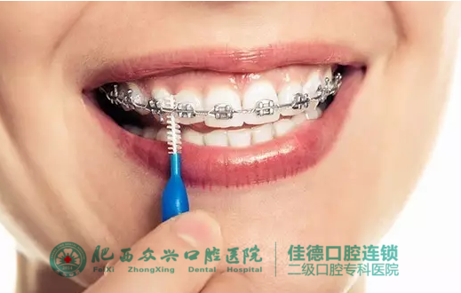 肥西成人隐形牙齿矫正多少钱？