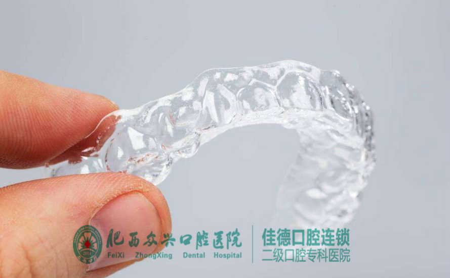 肥西儿童牙齿矫正要多少钱？