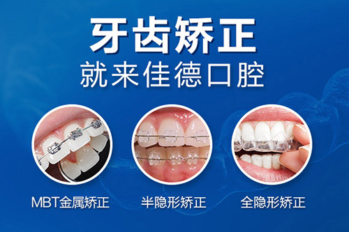 正畸优惠