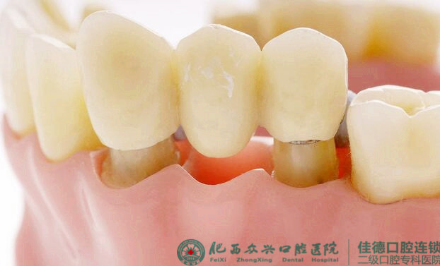 全口牙齿缺失危害