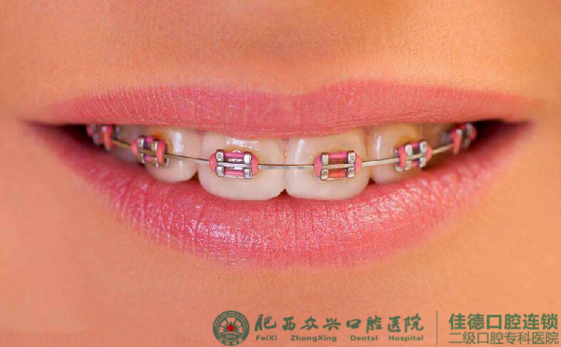 牙过小怎么修复