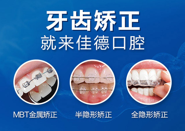 肥西牙齿矫正多少钱