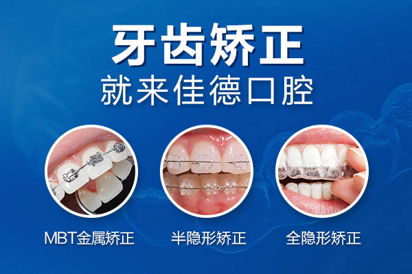 牙齿矫正优惠价